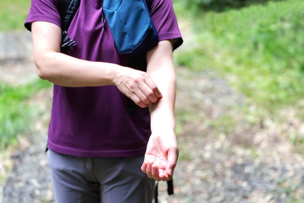 虫刺されで腕をかく男性