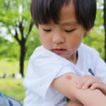 蚊に刺された子ども